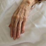 A 90year-old Woman Infected with Two COVID19 Variants Draws Attention to the Next Threat Before Completely Eliminating the Virus