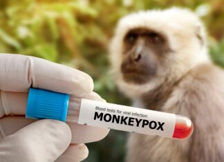 Fear of Monkeypox Is Making People Attack Monkeys